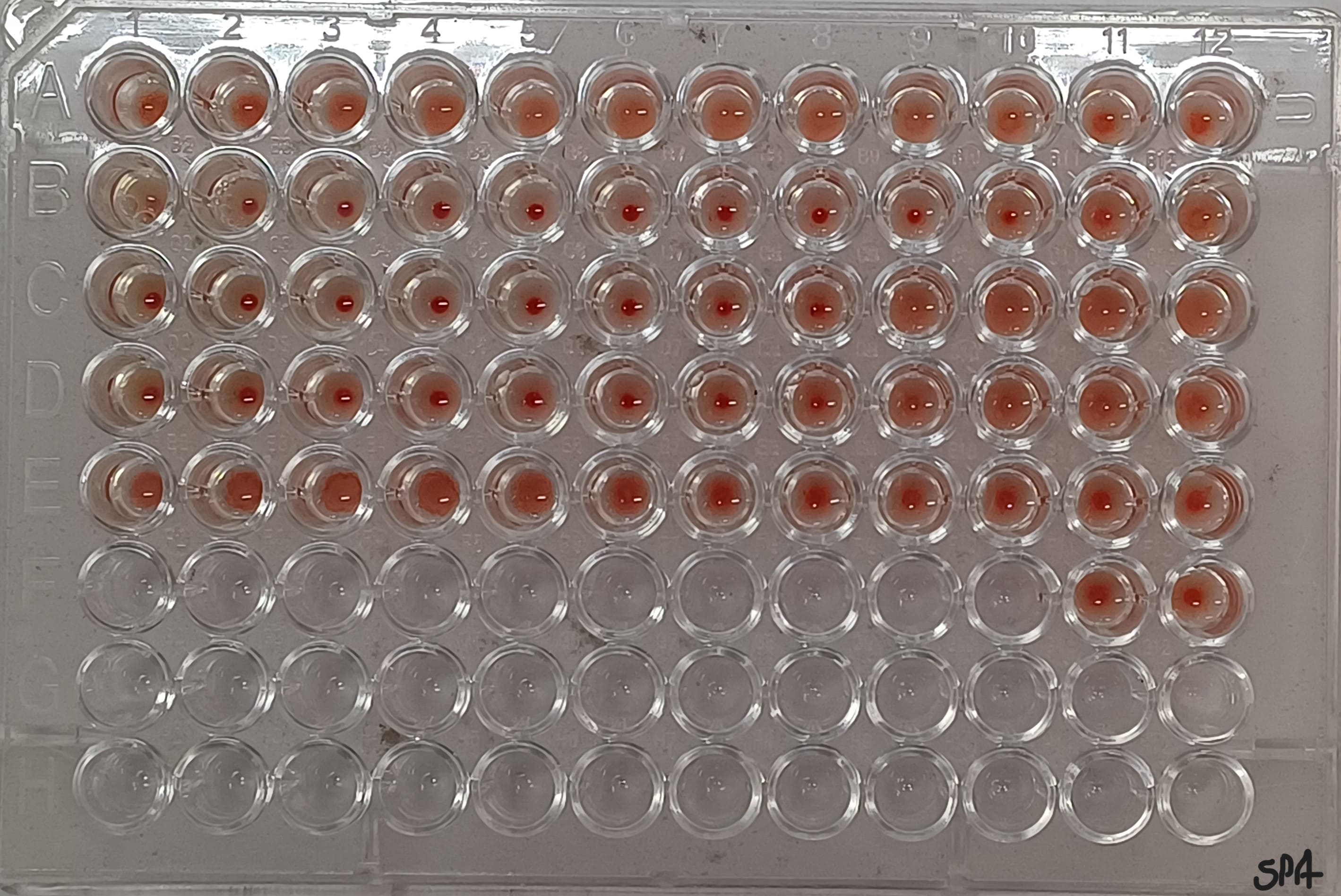 44. Haemagglutination Test (Paramyxo Viruses)